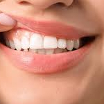 dentaguardprice